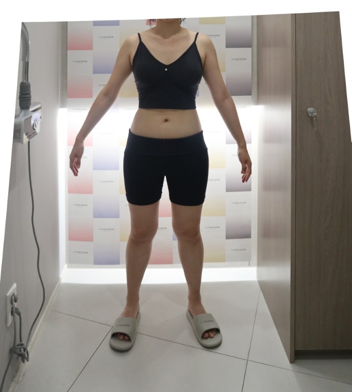 이정* Before